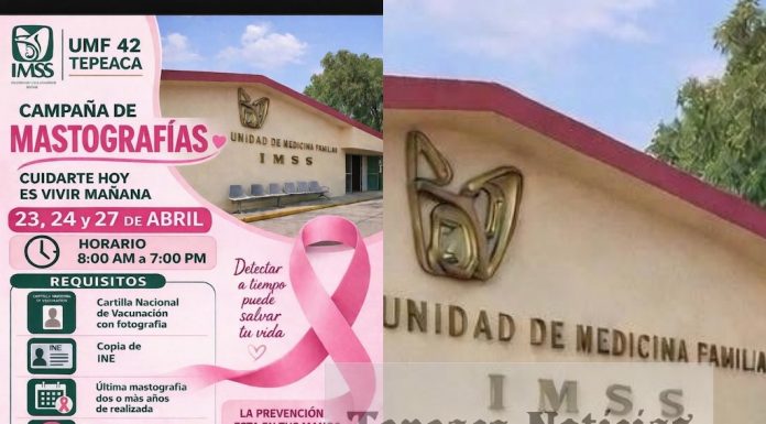 UMF 42 Tepeaca del IMSS pone en marcha campaña de mastografías gratuitas “Cuidarte hoy es vivir mañana”